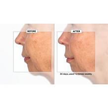 Active Argan Resurface Accelerating Peel