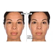 Active Argan Resurface Accelerating Peel