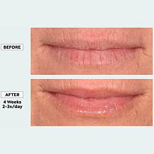 Active Argan Resurface Lip Treatment Balm - Auto-Ship®