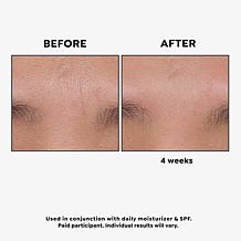 "As Is" BeautyBio GloPRO Skin Tool for Face & Body