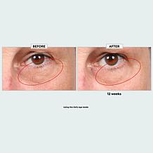 "As Is" Sharper Image Revel LED Light Therapy Face Mask