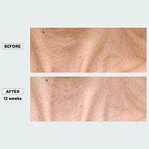 "As Is" Sharper Image Revel LED Light Therapy Neck & Décolletage Mask