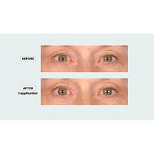 "As Is" Signature Club A RTC Infused Cool Tight Eye & Neck 2-piece Set