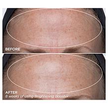 BeautyBio AM & PM Booster Set with Bag