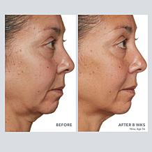 Beekman 1802 Milk RX Advanced Better Aging Renexosome Cream