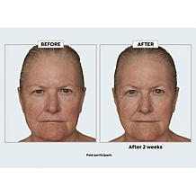 Beekman 1802 Potato Peel Milk Facial Auto-Ship®