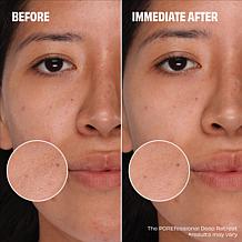 Benefit Cosmetics All You Knead is Pore Care Foaming Cleanser/Mask Duo