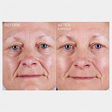 CurrentBody Skin LED Light Therapy Mask
