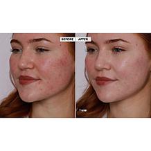 Doll 10 T.C.E Color Correcting Serum Stick