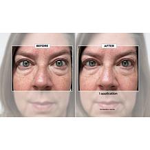 Dr. Brandt 2-pack No More Baggage Eye Gel