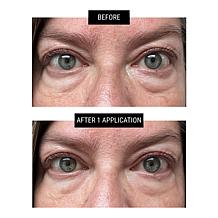 Dr. Brandt 2-pack No More Baggage Eye Gel