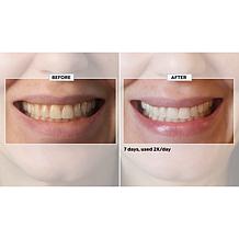 Intelliwhite 14-pack Ultra HAP+ Whitening Strips Auto-Ship®