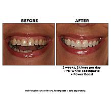 intelliWHiTE | Shop Teeth Whitening Kits, Toothpaste & Toothbrushes | HSN