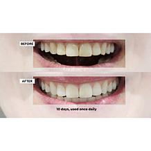 Intelliwhite Fusion 2-in-1 Whitening Serum Kit Auto-Ship®