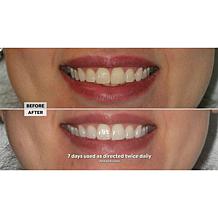 Intelliwhite Platinum Pen Whitening Kit Peppermint Auto-Ship®