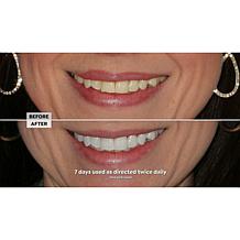 Intelliwhite Platinum Whitening Pen - Peppermint Auto-Ship®