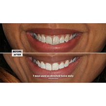 Intelliwhite Platinum Whitening Pen - Peppermint Auto-Ship®