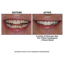 IntelliWHiTE® Power Boost Daily Whitening Gel Duo