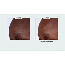 Isomers Diamond Peptide Exosome Perfecting Serum