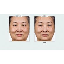 Isomers Skincare 14% Azelaic Acid Complex Radiance Cream