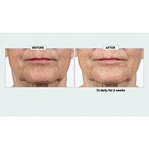 Isomers Skincare 14-Day Bootcamp Intensive Serum