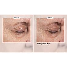 Isomers Skincare Bonus Size Multi-Corrective Eye Serum