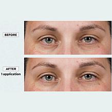 Isomers Skincare Fast Lift Eye Serum Set