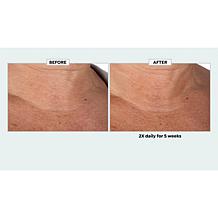 Isomers Skincare Matrixyl Anti-Wrinkle Serum