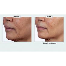 Isomers Skincare Matrixyl Hydration Boost Cream