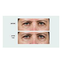 Isomers Skincare Next Youth Face and Eye 2-piece Set