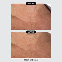 Isomers Skincare Special Edition Matrixyl Peptide Holiday Gift Set