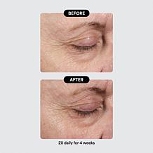 Isomers Skincare Special Edition Problem Solvers Holiday Gift Set