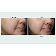 Kate Somerville 5 fl. oz. Jumbo Size ExfoliKate Exfoliating Treatment