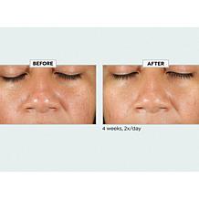 Kate Somerville KateCeuticals SuperCell Serum