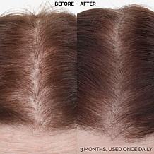 Keranique 120 Day Hair Regrowth Foam Bundle Auto-Ship®