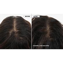 Keranique 120-Day Hair Regrowth Foam System with Scalp Massager