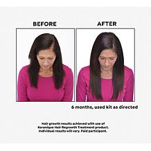 Keranique 90-Day Hair Regrowth Volumizing Kit