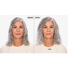 Keranique 90-Day Hair Regrowth Volumizing Kit