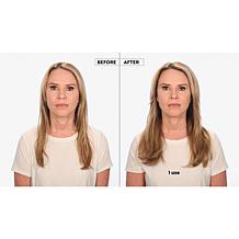 Keranique Hair Regrowth 60-Day Treatment w/ Scalp Massager Auto-Ship®