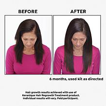Keranique Hair Regrowth 60-Day Treatment w/ Scalp Massager