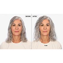 Keranique Hair Volumizing & Strengthening Kit