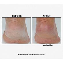 Korres Yoghurt ElastiSmooth Body Butter