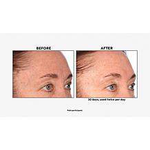 Lancôme Genifique Home & Go 2-piece Set Auto-Ship®