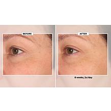 Lancôme Renergie Lift Multi Action Ultra Eye Cream
