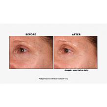 M. Asam Resveratrol NT50 Perfecting Eye Cream Auto-Ship®