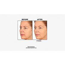 M. Asam Vino Gold Face Cream and Refill