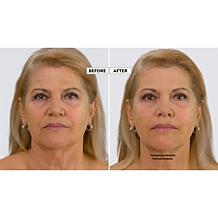 M. Asam Vino Rose 24-Hour Moisturizing Cream & Perfect Lift 2pc Set