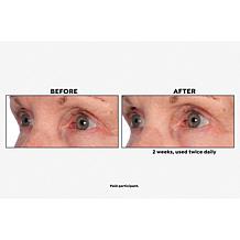 M. Asam VinoLift Skin Tightening Eye Balm 1.01 fl. oz.