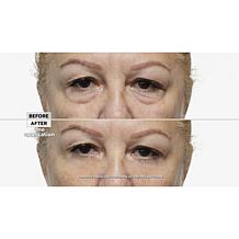 My Perfect Eyes .66 oz. Undereye Fix