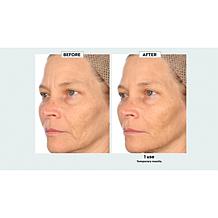 Nakery Beauty 2-pack Collagen Peptide & 25% Vitamin C Complex Serum